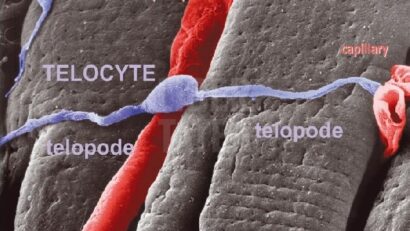 2014年8月8日： Telocytes细胞和肝再生