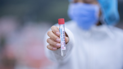 بؤر لتفشي وباء الفيروس التاجي المستجد في رومانيا